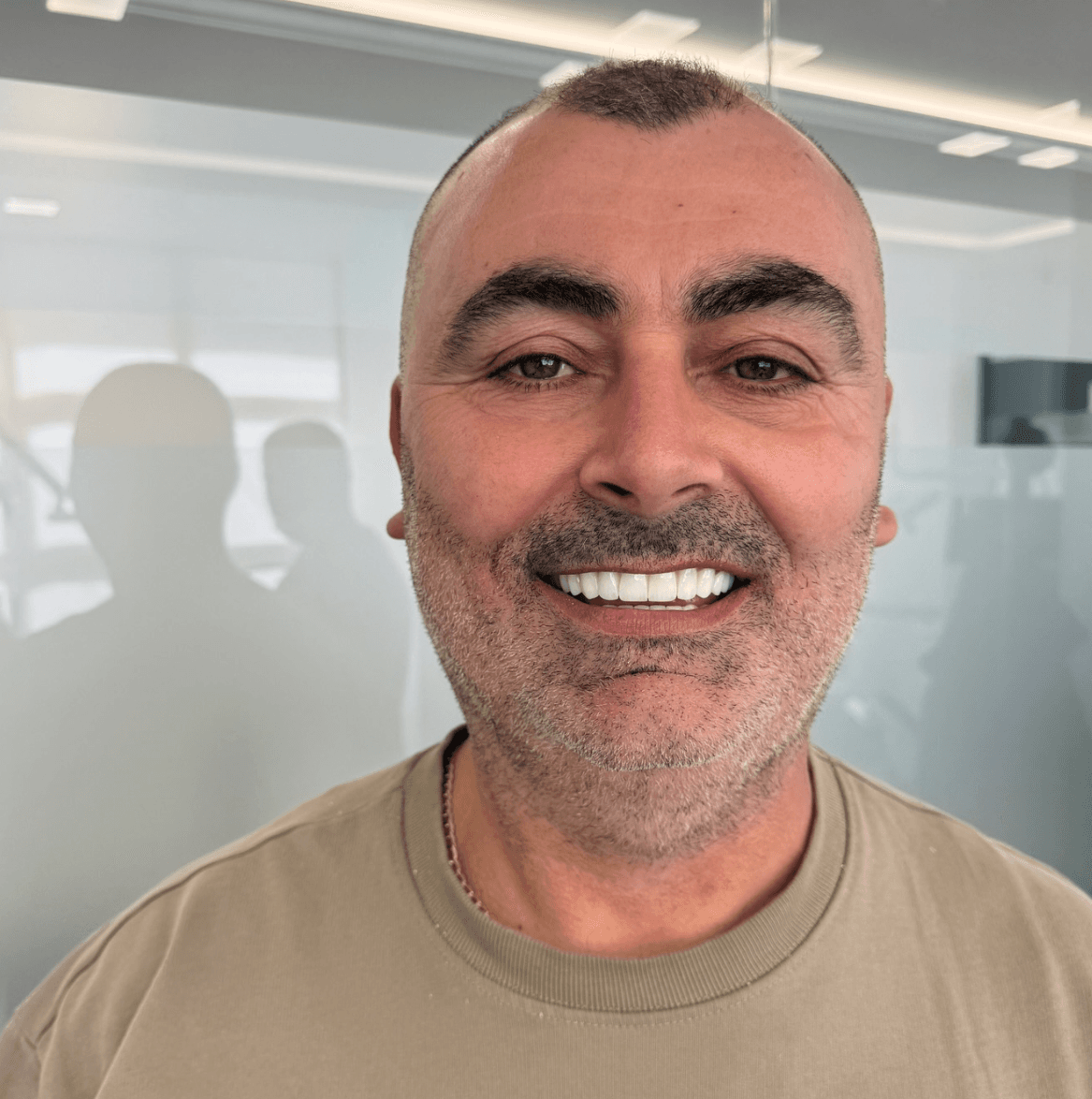 Patient smile result 4 — Durres Dental Clinic